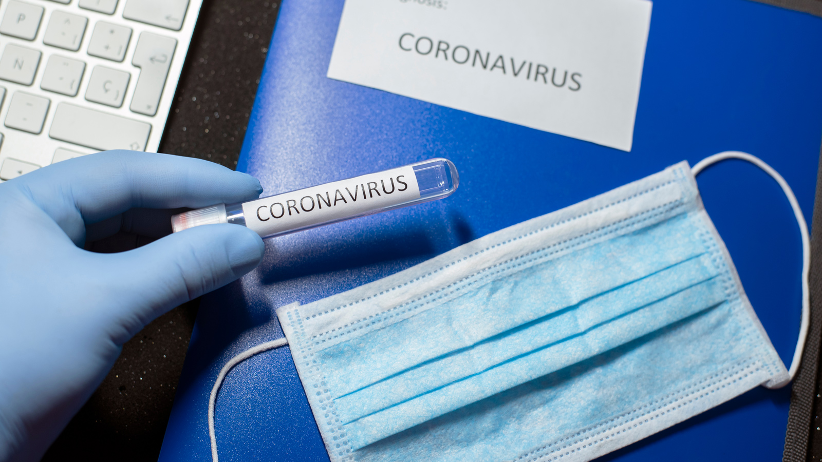 Bệnh viêm đường hô hấp cấp do virus Corona (nCoV) là gì? Nó nguy hiểm tới mức nào? Làm sao để đề phòng hiệu quả? Bài viết này sẽ giúp bạn nắm được tất tần tật những thông tin ấy.